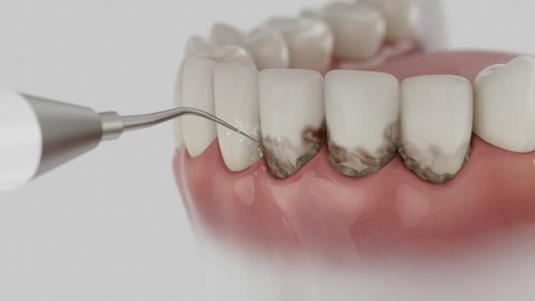 Trusted Root Canal Treatment service in Gibsonville, NC - Dentist Open Now